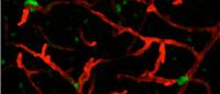 Image of therapy-resistant lung cancer cells hiding in the brain